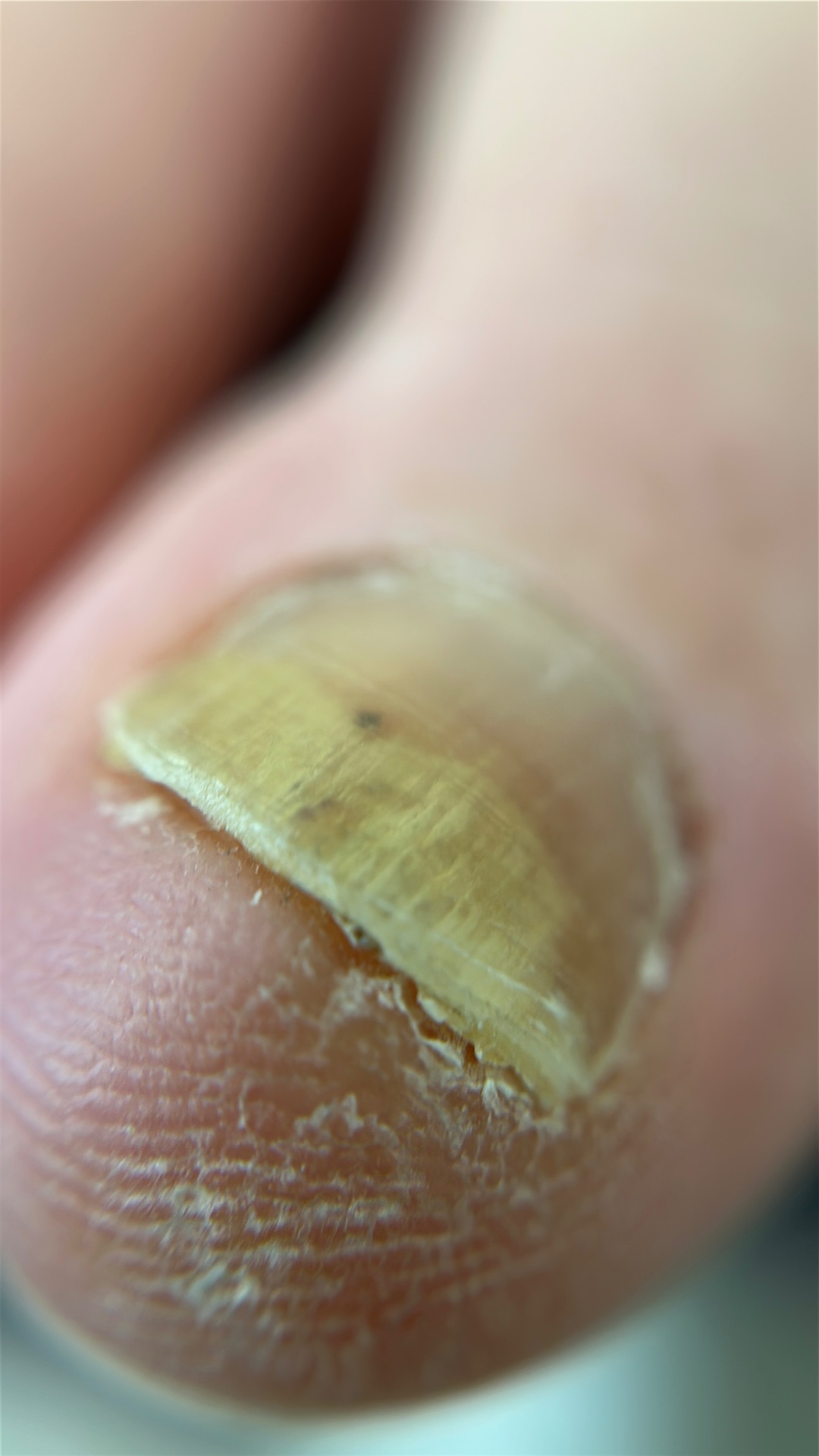 Nail Health Services